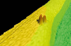 ���[�U�[���[�@�ɂ�鋛�ʂ̒��Ր}