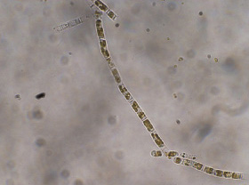 �X�P���g�l�}�E�R�X�^�c��